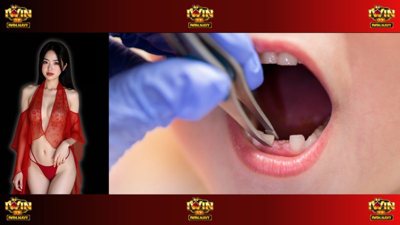 Ý nghĩa của giấc mơ thấy rụng răng